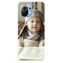 Coques Xiaomi 11 Lite 5g souples PERSONNALISEES