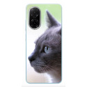 Coque Xiaomi Redmi A5 personnalisée: Faite en France et livraison en 48H