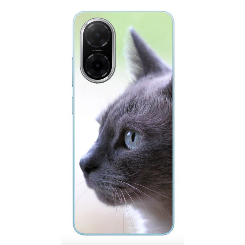 Coque Xiaomi Redmi A5 personnalisée avec une photo Coque Xiaomi Redmi A5 personnalisée avec une photo