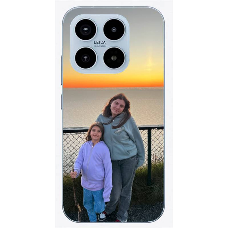 Coque Xiaomi 17 personnalisée
